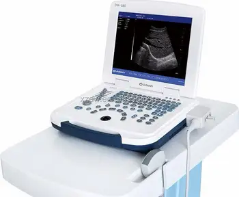 Гореща продажба на Преносими диагностична сонографии и УЛТРАЗВУК, ултразвуков скенер и преносим портативен лаптоп ултразвук